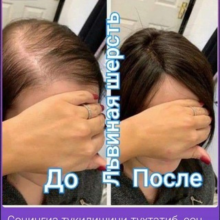 ТУКИЛГАН СОЧЛАРНИ КАЙТА ТИКЛАШ ТАБИИЙ ВА ЗАРАРСИЗ КРЕМ МАСКА