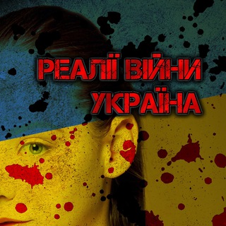 РЕАЛІЇ ВІЙНИ | УКРАЇНА