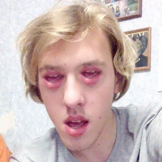 СКРЕЖЕТ УВАРОВА