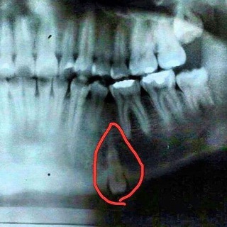 ORTHOPONTO 