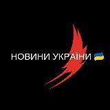 НОВИНИ УКРАЇНИ  ВІЙНА