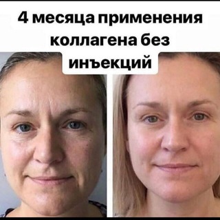 ОТЗЫВЫ20 / КОЛЛАГЕН/ COLLAGEN NL ФОТО/ ОТЗЫВЫ